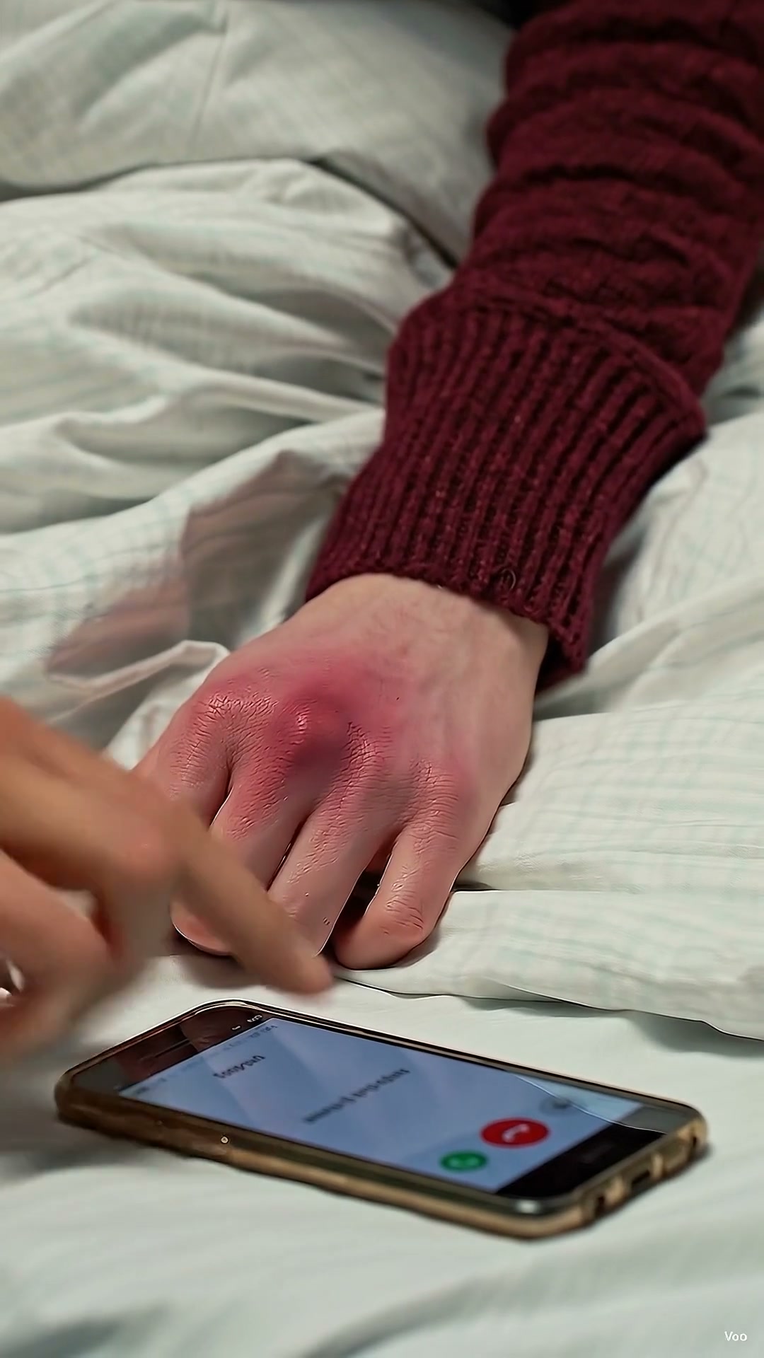 Mon frère m’a brisé le poignet, mais l’hôpital a découvert bien pire